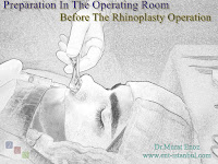 Preparation Before The Rhinoplasty Operation, Preparation For Nose Aesthetic Surgery, Local anesthesic injection before the surgery