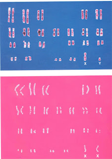 Karyotype