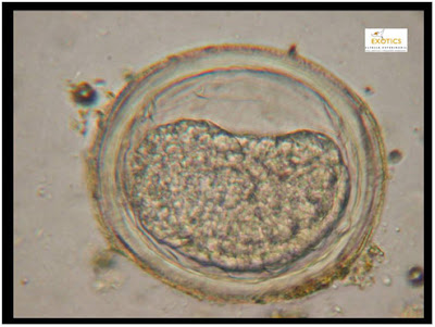 Huevo ampliado de un áscaris