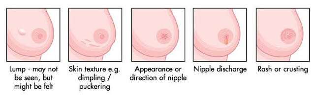 self examine test for breast cancer