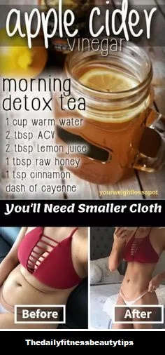 apple cider vinegar for weight loss