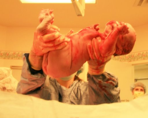 Kondisi Normal Bayi Saat Baru Lahir  Ibu Hamil