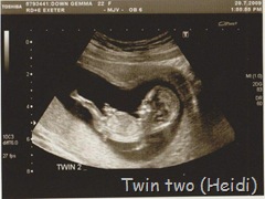 Twin2 12wks 20.7.09