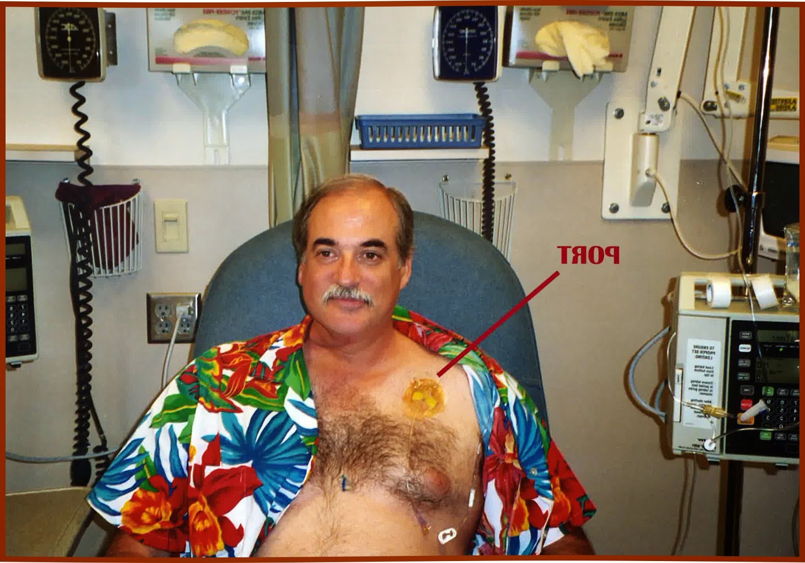 Adenocarcinoma Prognosis