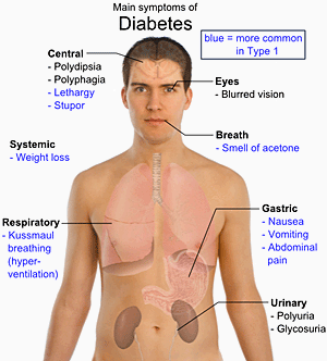 Nursing Intervention for Diabetes