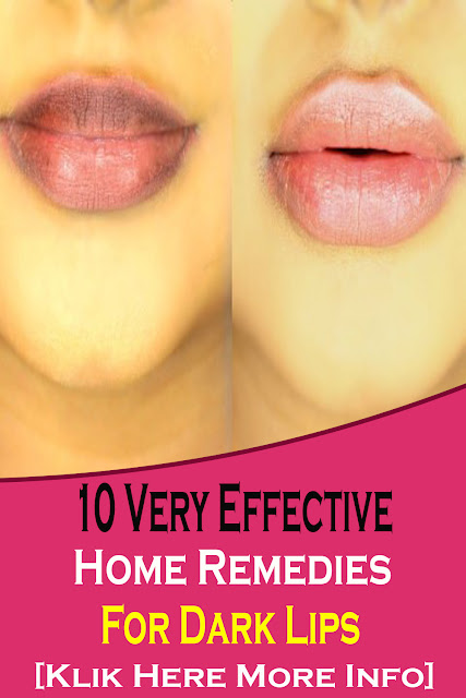 10 Very Effective Home Remedies For Dark Lips