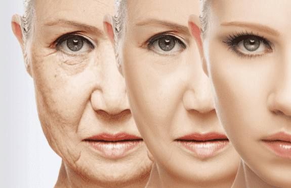  cara mengatasi penuaan dini pada cukup umur Ingin Menghindari Penuaan Dini? Atasi dengan Cara Tepat Sedari Dini!