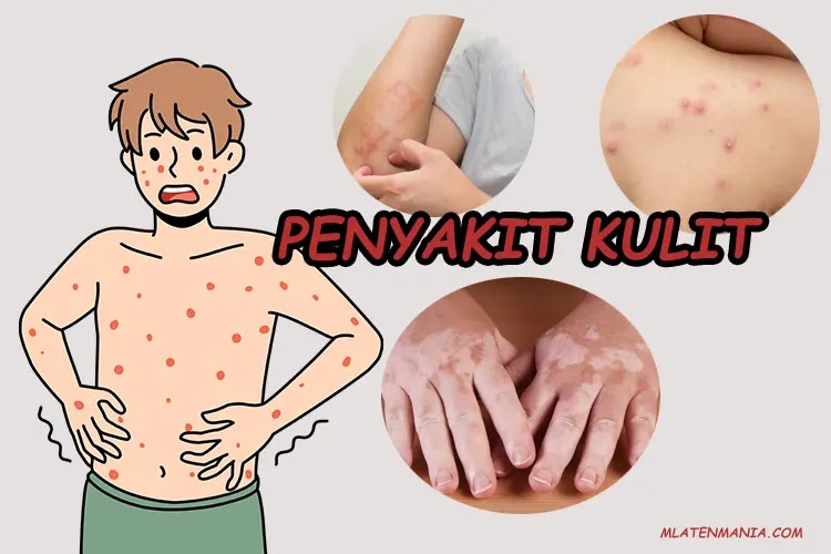 Mengenal Lebih Dekat Dengan Penyakit Kulit