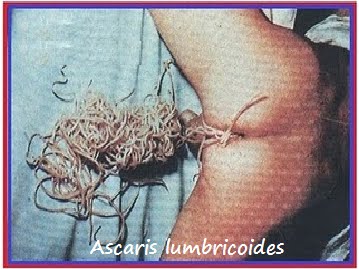 BIOLOGI GONZAGA: CACING PERUT-ASCARIS LUMBRICOIDES