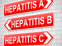 Apa Perbedaan Hepatitis A, Hepatitis B Dan Hepatitis C Yang Kamu Harus Tahu