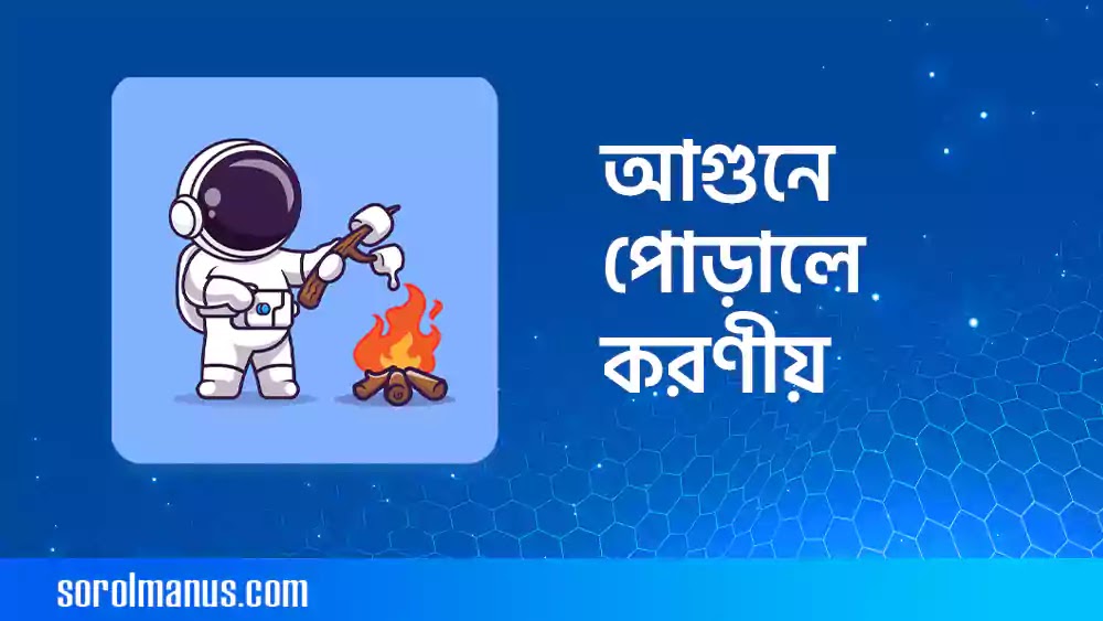 আগুনে পোড়ালে করণীয় সম্পর্কে বিস্তারিত