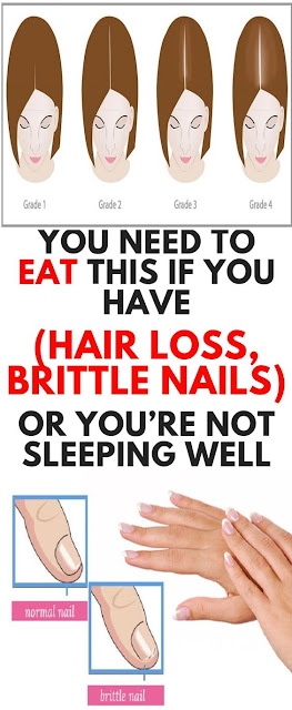 You Need To Eat This If You Have Hair Loss, Brittle Nails Or You’re Not Sleeping Well