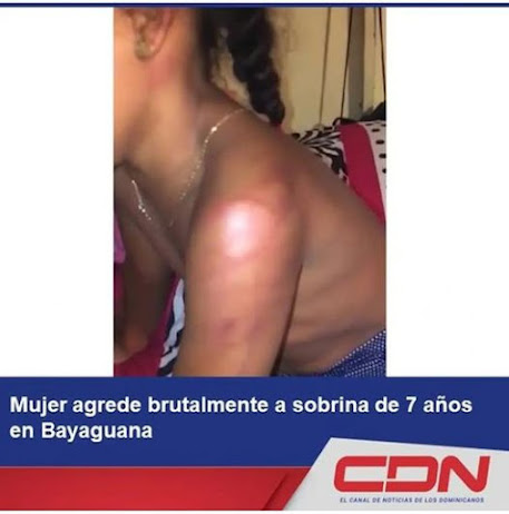 Mujer en bayaguana le propino golpes brutalmente a una sobrina de 7 años.