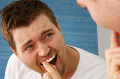 Cách chăm sóc sau khi nhổ răng khôn