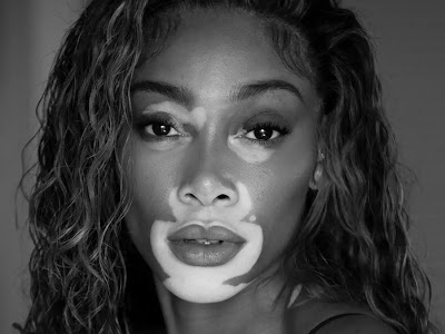 Winnie Harlow by Nikki Esser