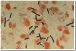 KOLEKSI TUGASAN: Mikrobiologi : CLOSTRIDIUM BOTULINUM 