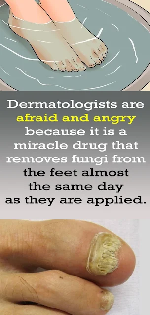 Dermatologists are afraid and angry because it is a miracle drug that removes fungi from the feet almost the same day as they are applied