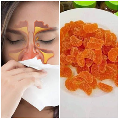 Finir la congestion nasale : DIY gummies vitamine C pour augmenter les défenses