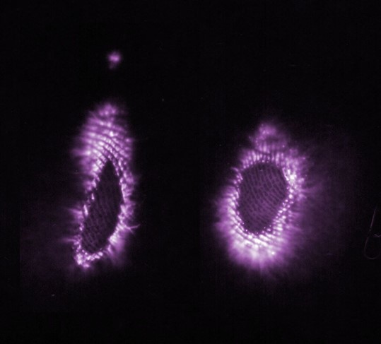 Kirlian photography