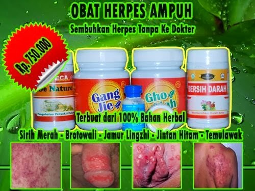 Obat Herpes Terbaik