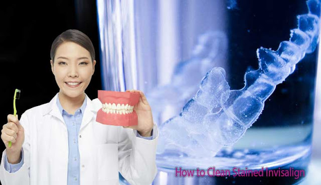 How To Clean Stained Invisalign Invisalign Support