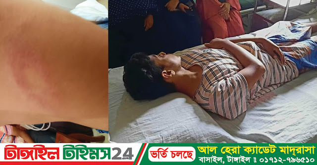 বাসাইলে কিশোরগ্যাংয়ের হামলায় এসএসসি পরীক্ষার্থী মারাত্মক আহত