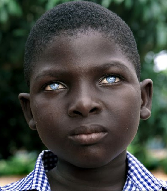 Black Person With Blue Eyes