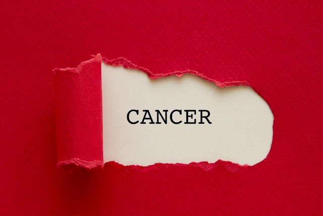 Tubuh kita terdiri badan dan anggota badan yang dihubungkan oleh pembuluh Proses Terjadinya Tumor atau Kanker