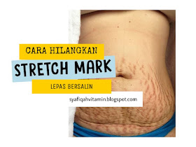 stretch mark