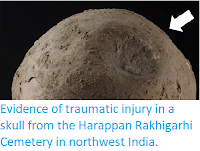 https://sciencythoughts.blogspot.com/2019/05/evidence-of-traumatic-injury-in-skull.html