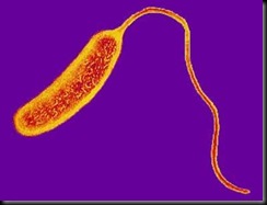 Vibrio cholrea