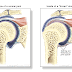 Acupuncture Frozen Shoulder