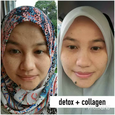 Testimoni Kulit Berseri Dan Anjal Dengan Produk Shaklee