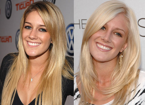 heidi montag surgery before after. heidi montag before and after