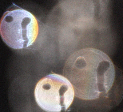 weeping eye pattern
