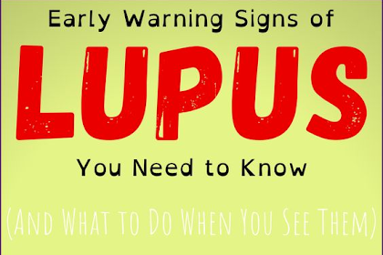 Early Warning Signs of Lupus You Need to Know (And What to Do When You See Them)