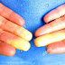 Raynaud syndrome