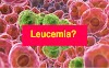 Leucemia - O que é, tipos, sintomas, tratamento