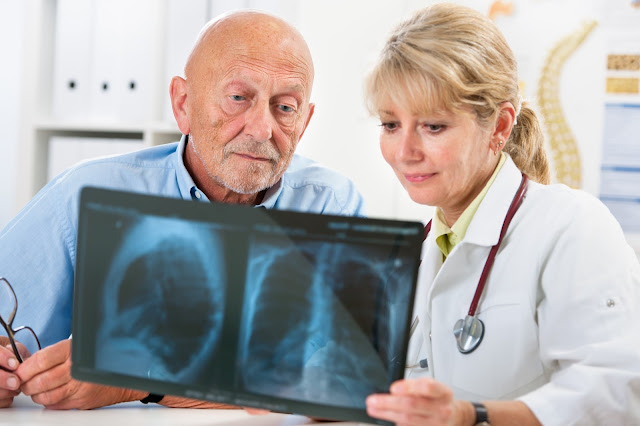 mesothelioma diagnosis