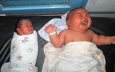 The largest baby in the world is 23 lb. It is being compared to an average-sized baby,
