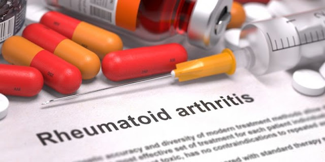 Rheumatoid arthritis treatment