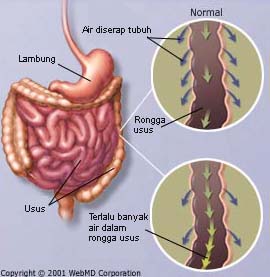 Gejala dan Penyebab Penyakit Diare