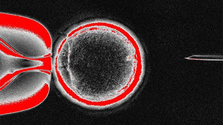 Células Tronco São Criadas Por Clonagem De Humanos
