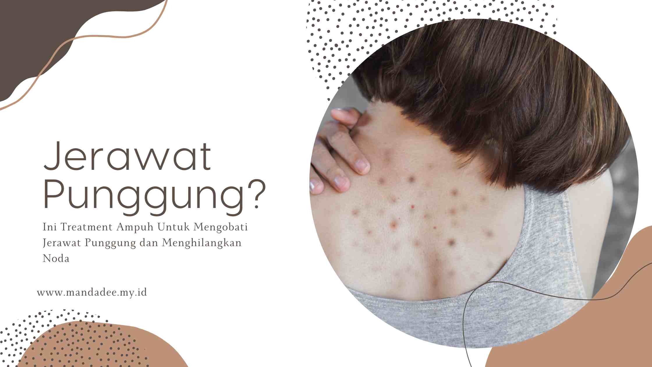 treatment jerawat punggung