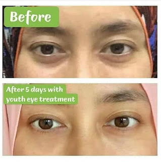 Testimoni YOUTH Restoring Eye Treatment