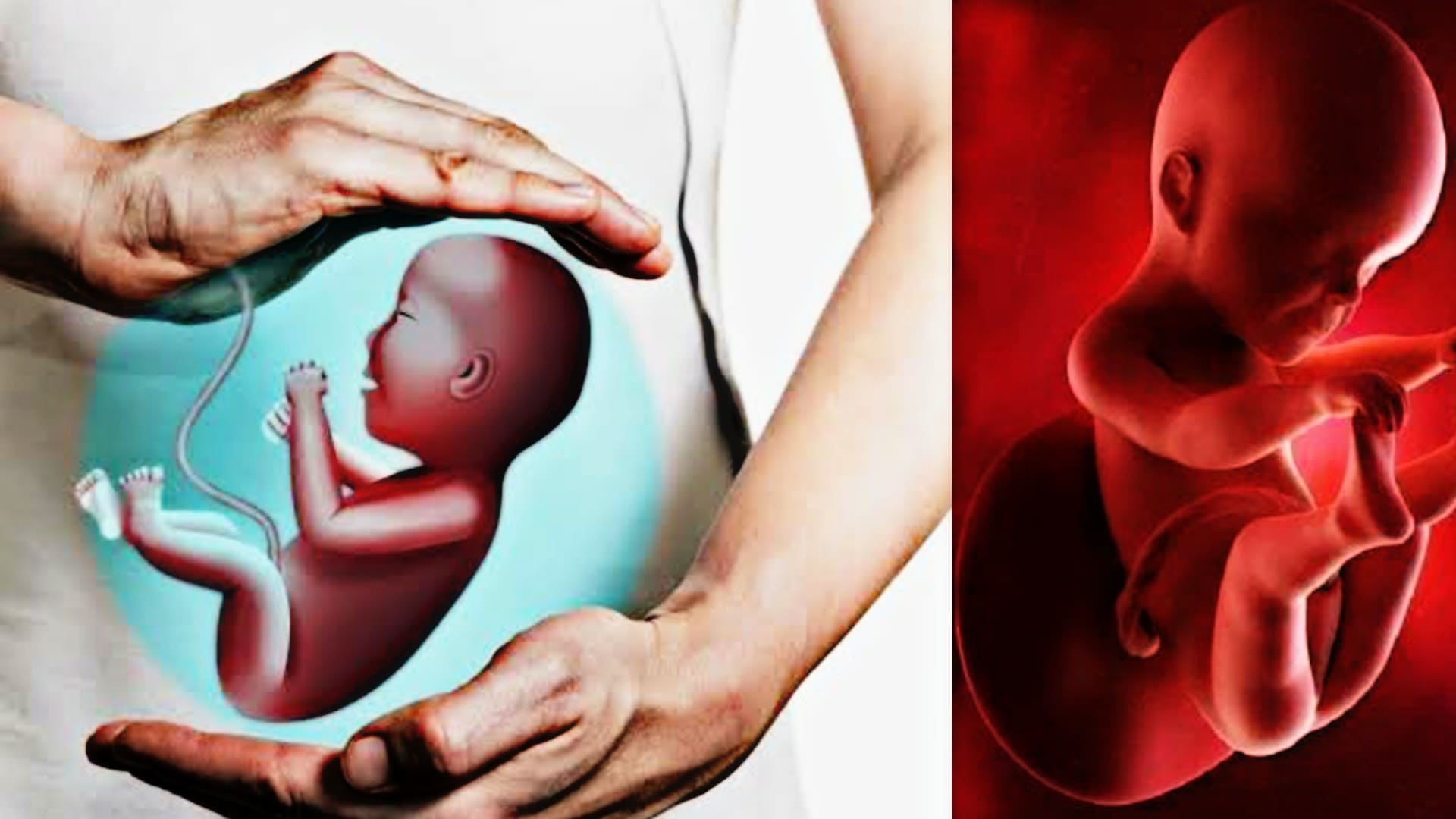 What is fetal malformaty