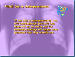 Slide7