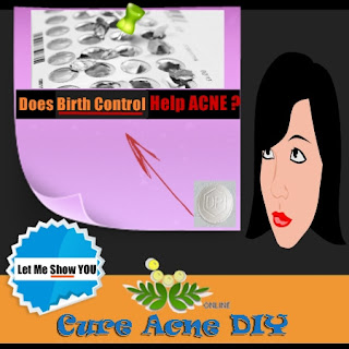 does birth control help acne?