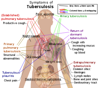 Pharmacotherapy of tuberculosis