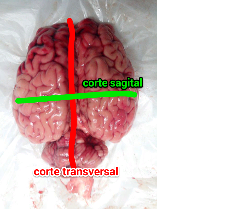 Resultado de imagen de corte transversal del cerebro